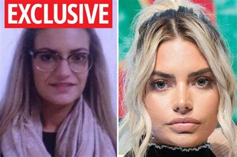 megan before surgery love island|megan barton hanson love island.